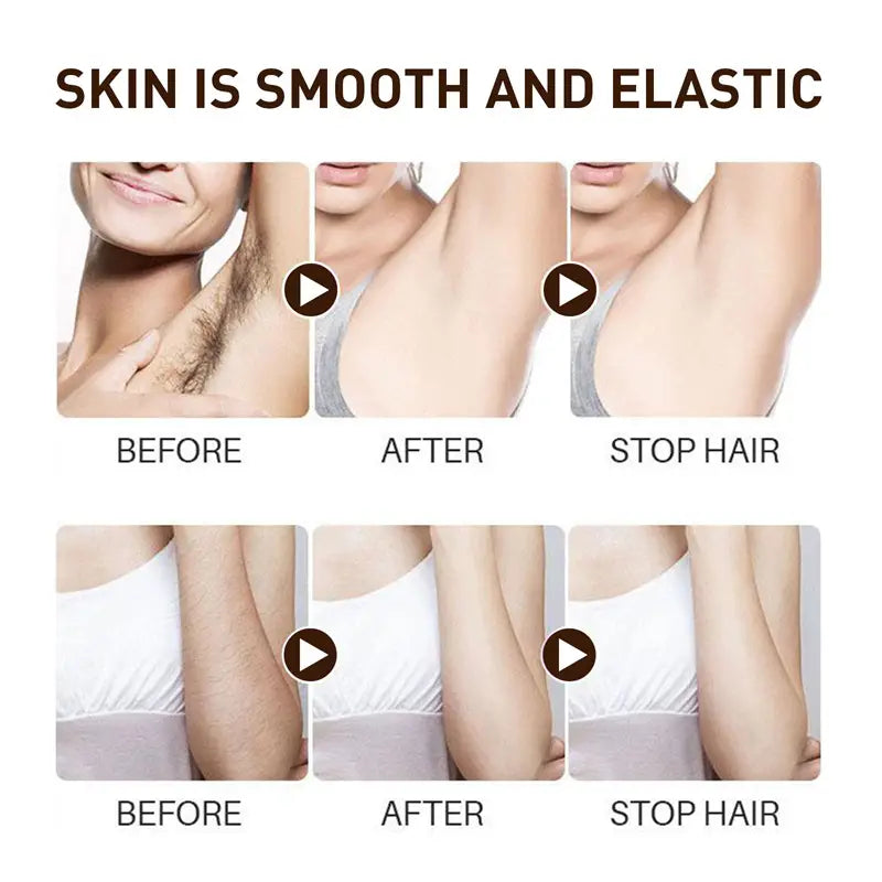 Gentle Hair Removal Spray for Whole Body - 30ml